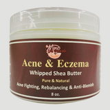 Mine Botanicals Whipped Shea Butter Acne & Eczema 8oz